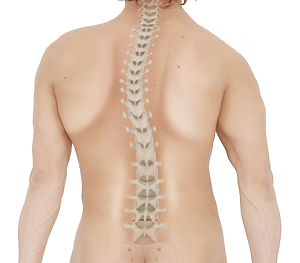 Adult Kyphosis