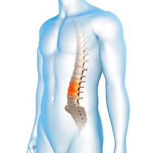 Degenerative Spine