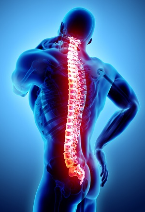 Spondyloarthropathies